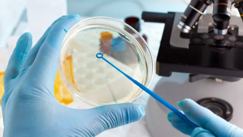Industrial Microbiology Market Scope, Size, Implementation, Analytical Overview, Forecast 2030
