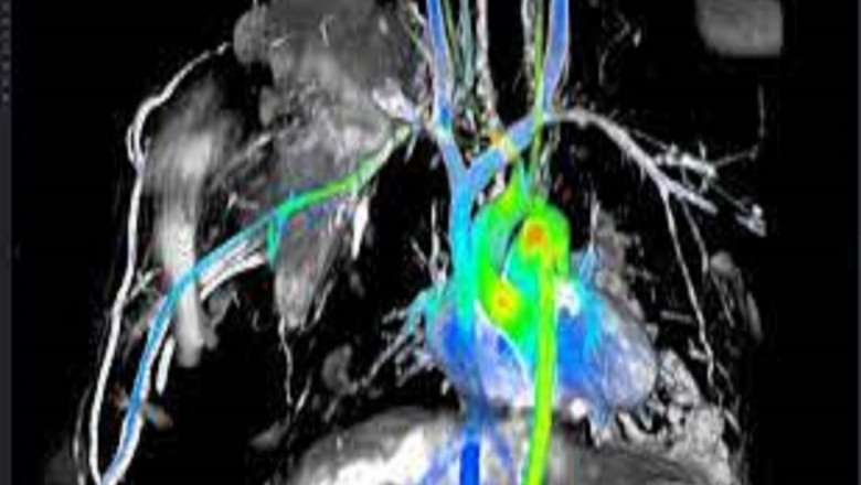 Cardiac MRI Testing Systems Market Size, Share, Growth, Opportunities and Global Forecast to 2028