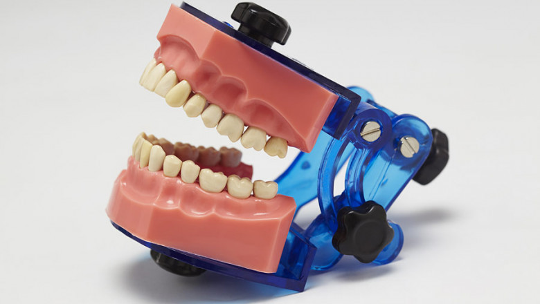 Root Canal Treatment | Dental Clinic in Gurgaon - The Dental Home