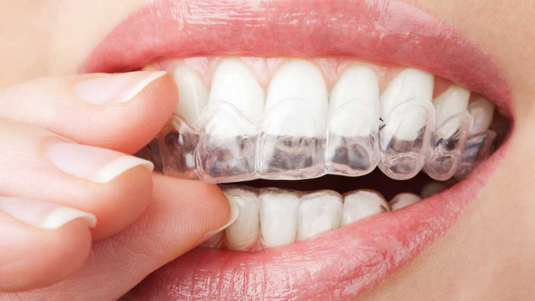 What Would Dentures Do For You?