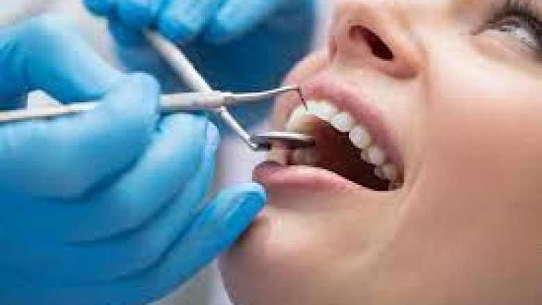 Why Dental Financing is Important